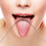 Tongue Scrapers